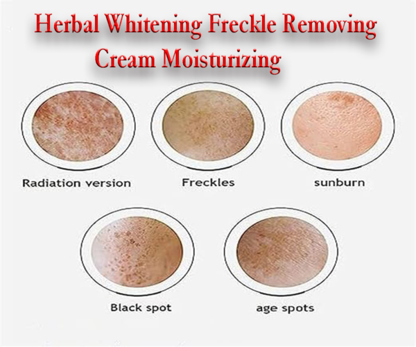 DR.HANCY Yunnan Herbal Whitening Freckle Removing Cream Moisturizing Fade Spots Brightening Face Cream for radiant skin. - Image 4